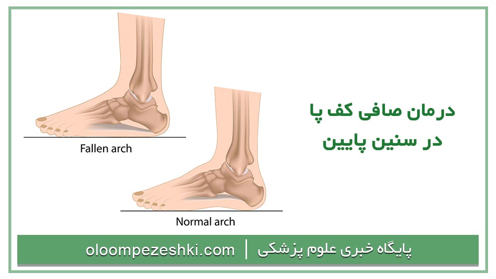  قابل درمان بودن صافی کف پا در سنین پایین