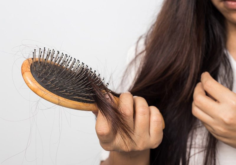 اصلی‌ترین دلایل ریزش موی شدید چیست؟ آیا راه درمانی دارد؟